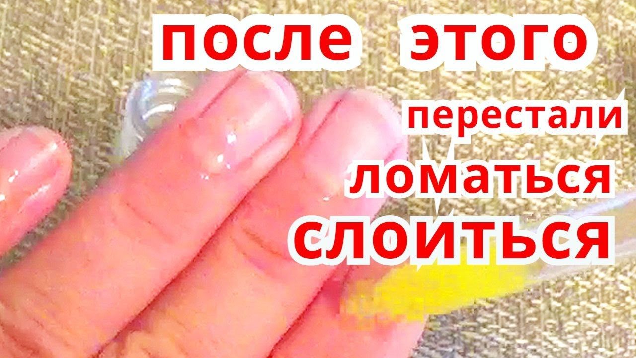 Как укрепить ногти - простые методы в домашних условиях