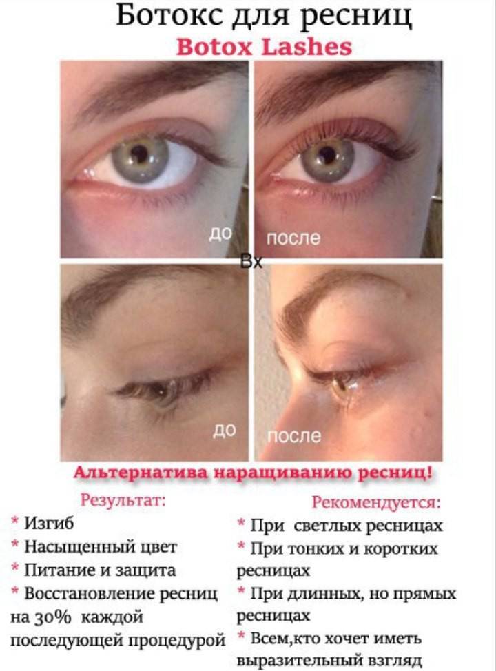 Ламинирование и ботокс ресниц – в чем разница процедур, можно ли делать их одновременно 2024