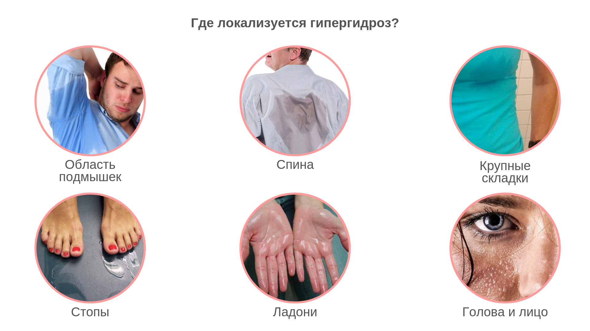 Потливость рук и ног: причины и способы лечения