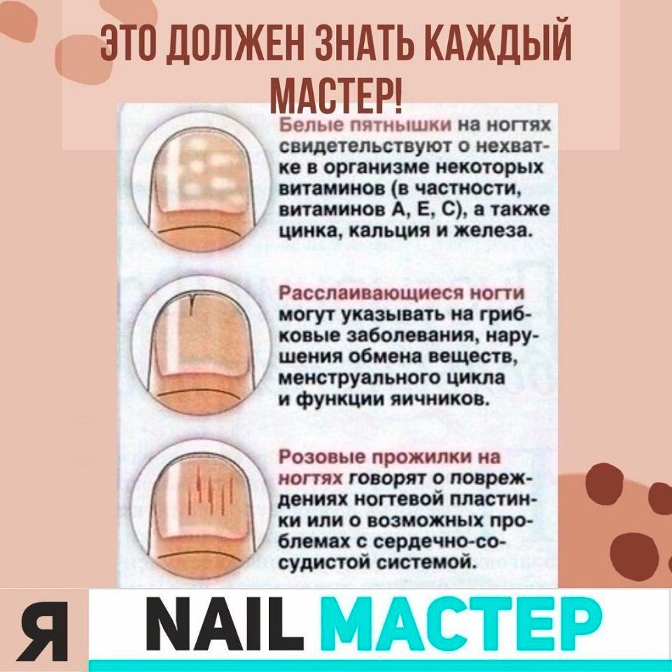 Ногти после наращивания: как восстановить и спасти испорченные, тонкие, ломкие ногти после наращивания гель-лаком? советы, отзывы и методы