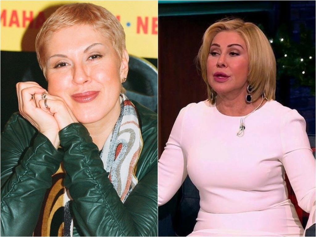 Любовь успенская до и после пластики. фото