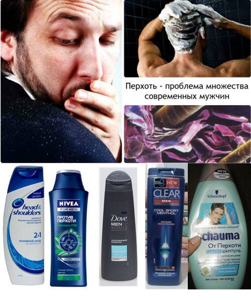 Как быстро избавиться от перхоти без шампуня - клиника «доктор волос»