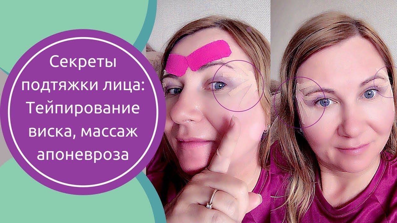Что такое тейпирование лица и какие результаты даёт процедура?