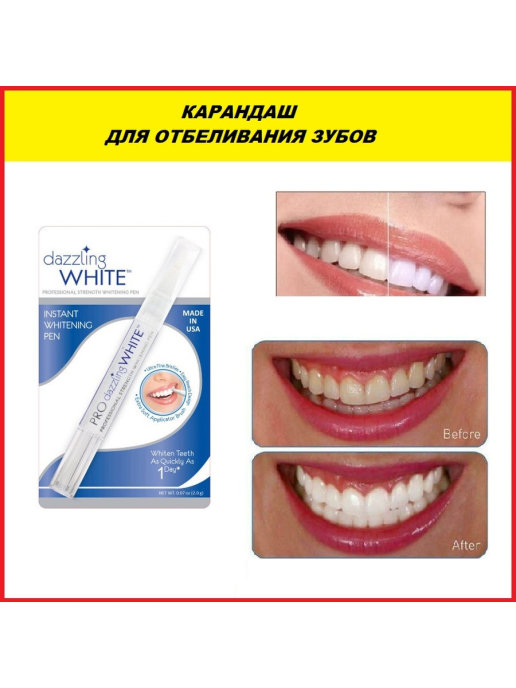 Преимущества карандаша для отбеливания зубов bright white: отзывы и инструкция по применению для белоснежной и ослепительной улыбки