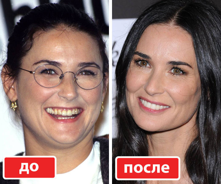 Деми мур до пластики, после первой и последней | marykay-4u.ru