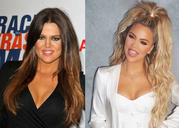 Хлои кардашян: опыт пластики “страшненькой” сестры. хлоя кардашьян — фотографии светской дивы после пластических операций на лице и теле