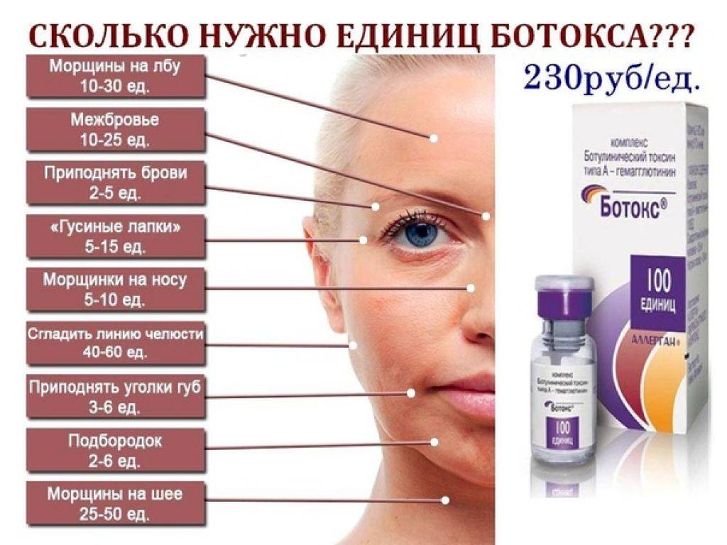 Сравнение ботулотоксинов: ботокс, диспорт, ксеомин, лантокс, нейронокс, релатокс