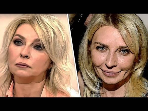 Татьяна овсиенко после пластики стала моложе?