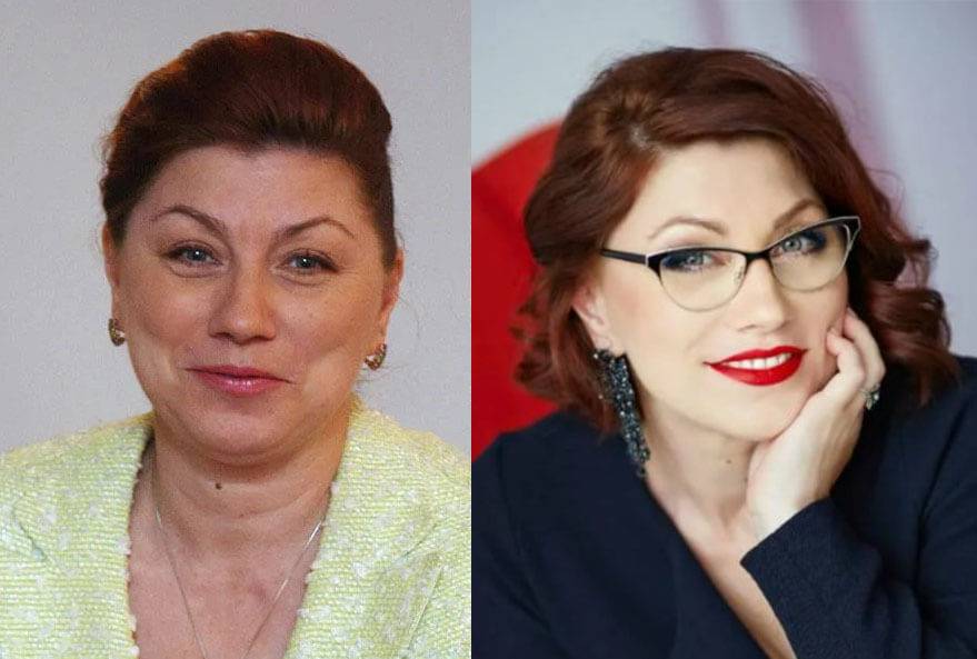 Пластика розы сябитовой: какую и где делала, результат до и после | marykay-4u.ru