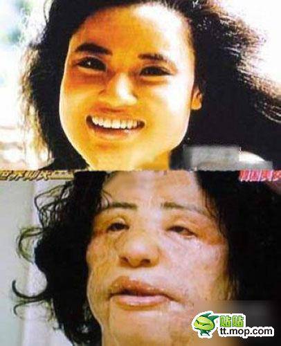 До ужаса красивы:15 шокирующих пластических операций, завершившихся плачевно