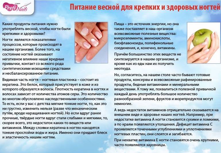 «хрупкие ногти». что делать, когда ногти слоятся и ломаются?