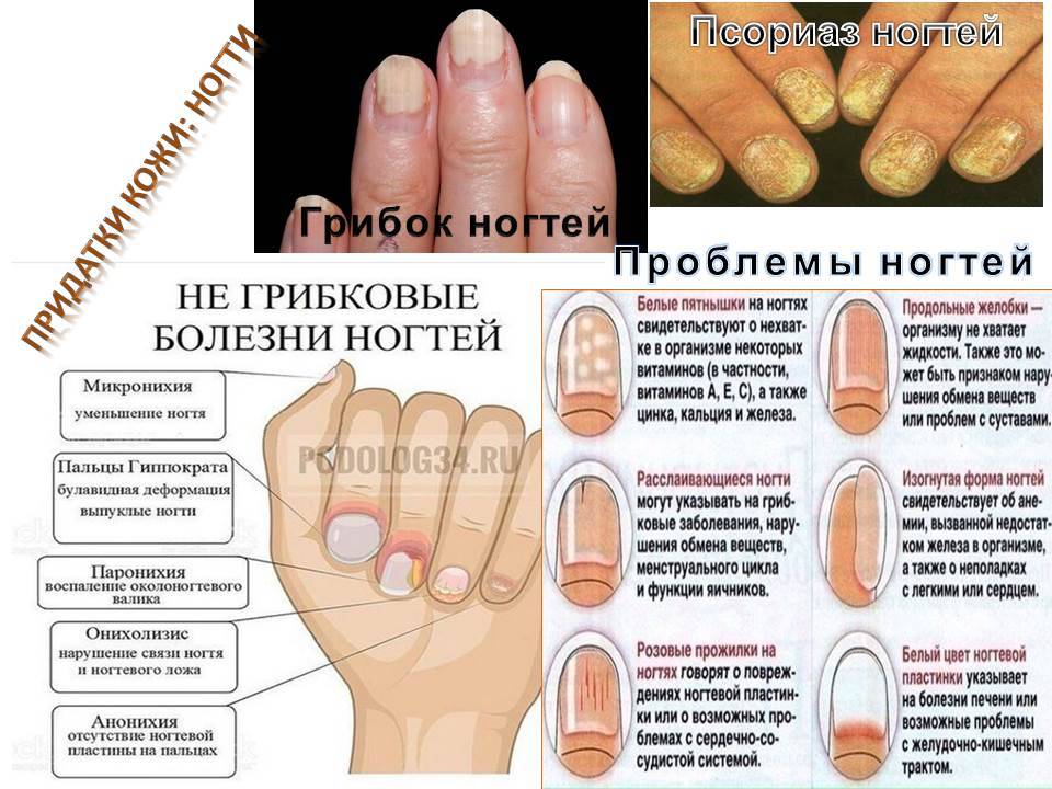 Причины пожелтения ногтей на руках