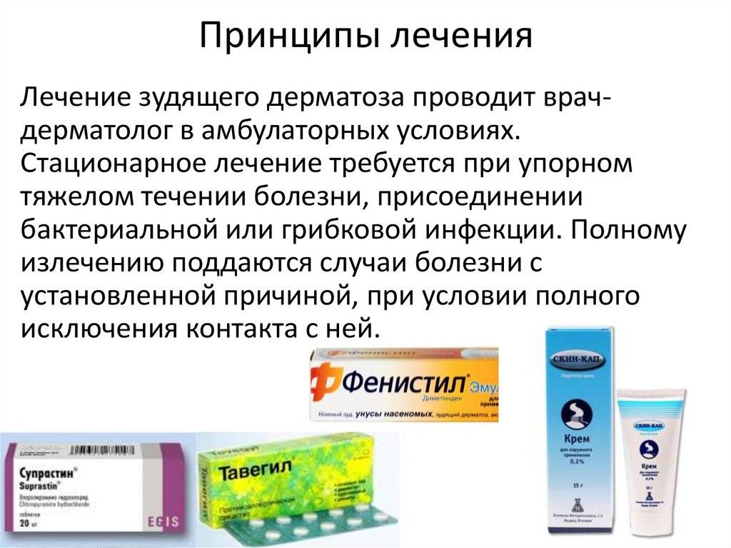 Нейродермит: лечение в домашних условиях эффективными методами