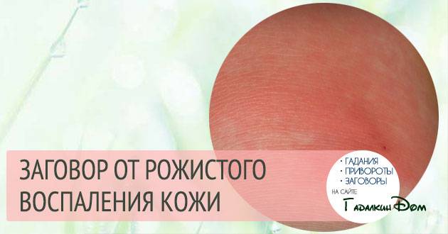 Лечение рожи антибиотиками и народными средствами