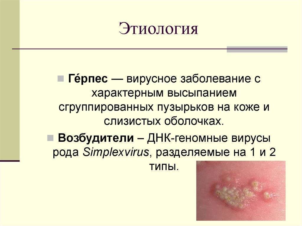 Лишай у человека: фото, признаки и лечение