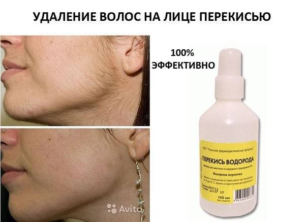 Удаление волос содой: достоинства и недостатки, грамотное применение