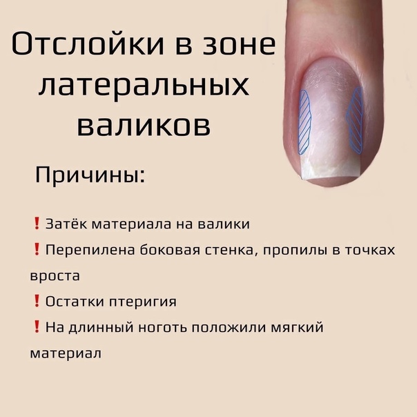 Дефекты лакокрасочного покрытия, мелкие повреждения