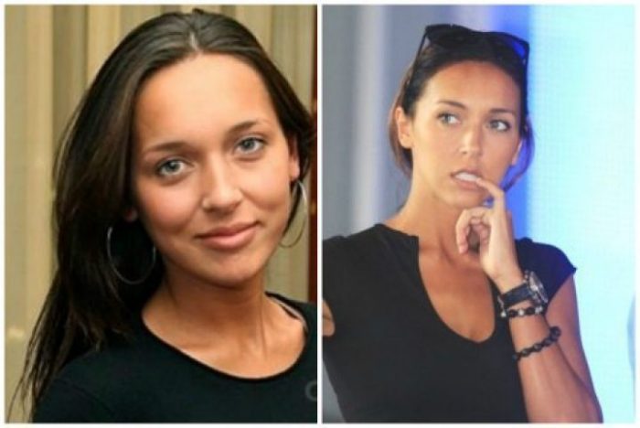 Алсу: пластика, которую делала певица, изменения носа, груди, губ, внешность до и после | marykay-4u.ru