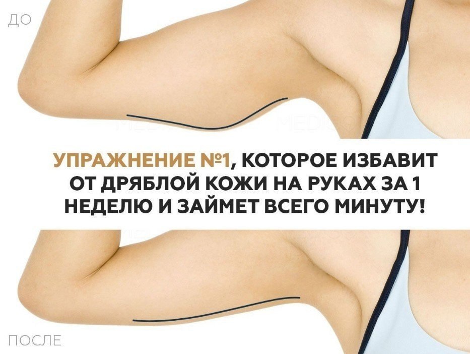 Подтяжка внутренней стороны рук. как подтянуть руки с внутренней стороны женщине