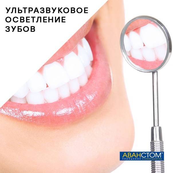 Домашнее отбеливание зубов с капами — зубы