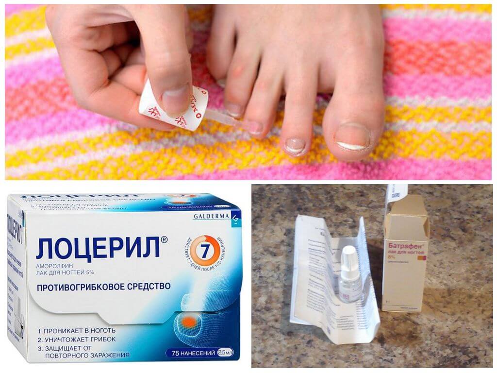 Эффективные противогрибковые препараты для ногтей ног