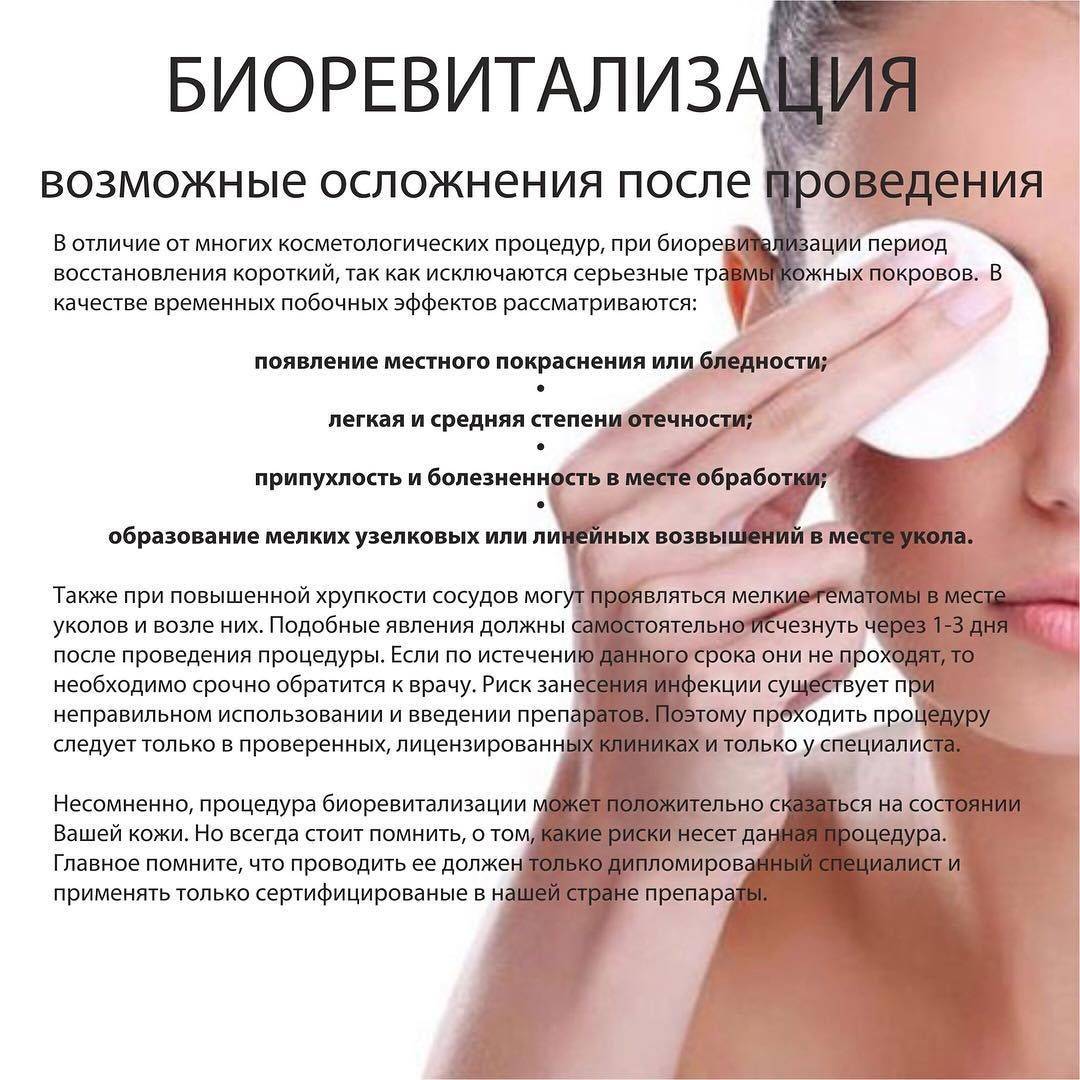 Биоревитализация лица – суть, плюсы и минусы процедуры