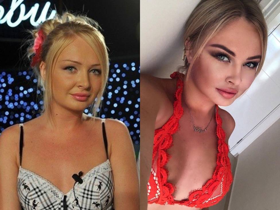 Пынзарь сделала пластику. даша пынзарь увеличила себе грудь