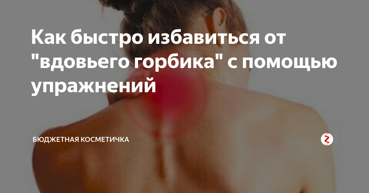 2 упражнения, чтобы убрать холку на шее (видео)