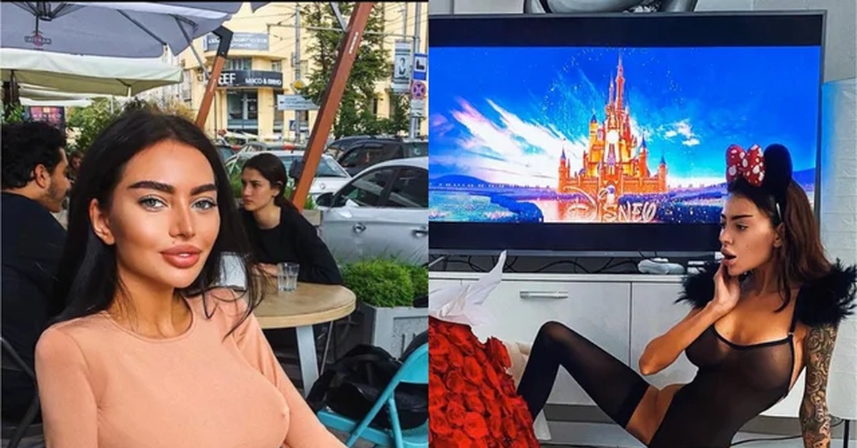 Алена омович. фото до и после пластики - женский журнал