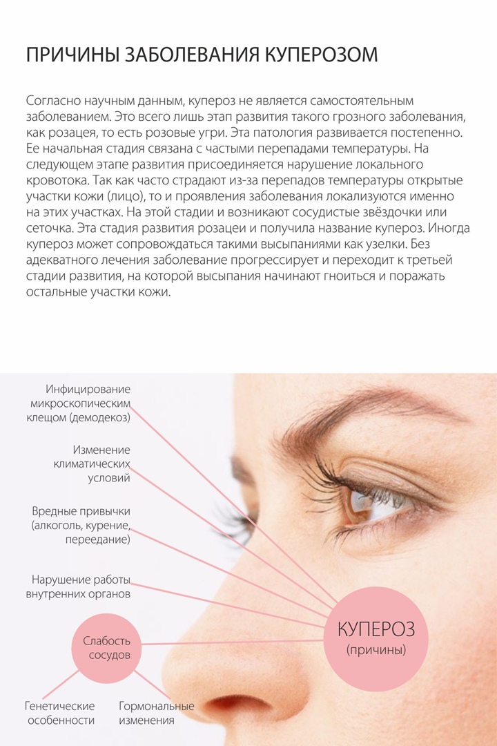 Как убрать сосудистые звездочки на лице
