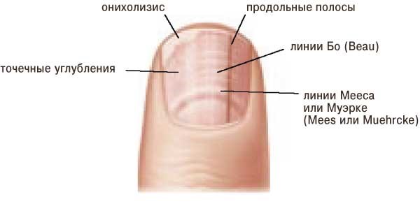 Продольные полосы на ногтях: причины появления, диагностика проблемы и способы лечения