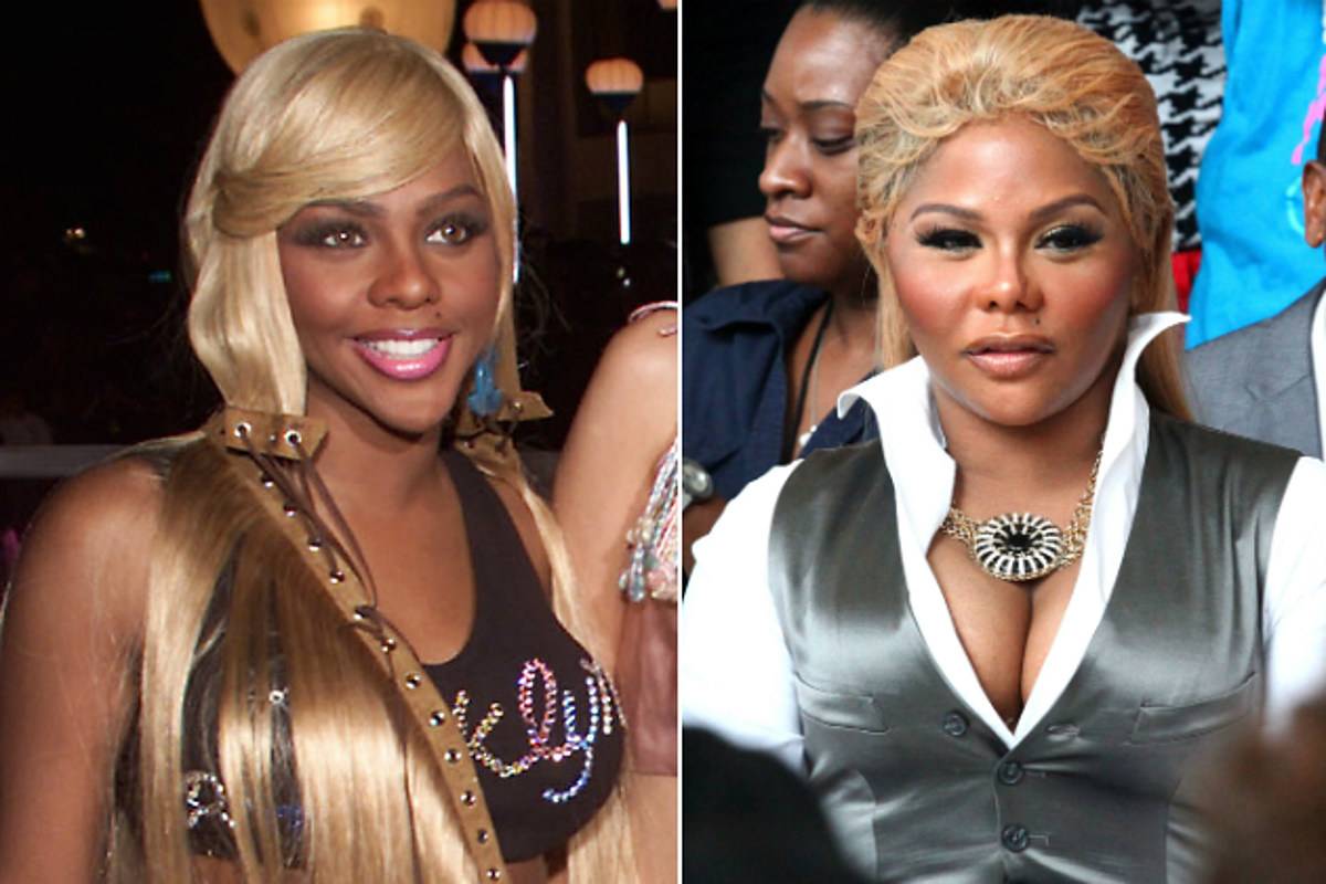 Lil kim plastic surgery 2024