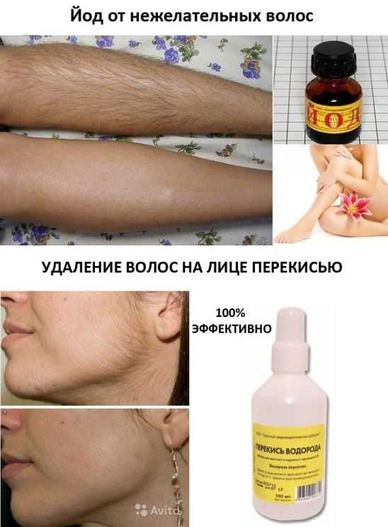 Как удалить волосы в домашних условиях на лице и теле отзывы, средства