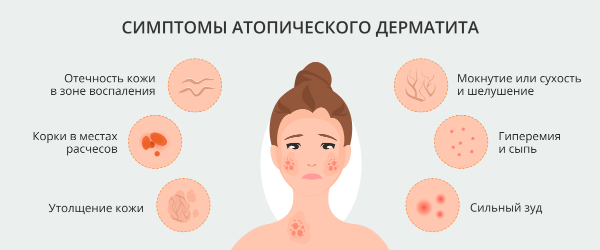 Почему сохнут губы: причины сухости губ у женщин, признаки заболеваний, лечение