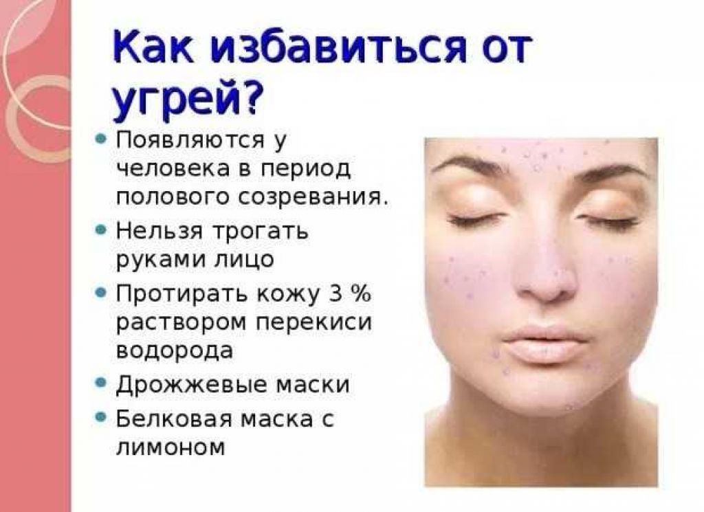 Угри на лице: причины, лечение, салонные процедуры, народные средства