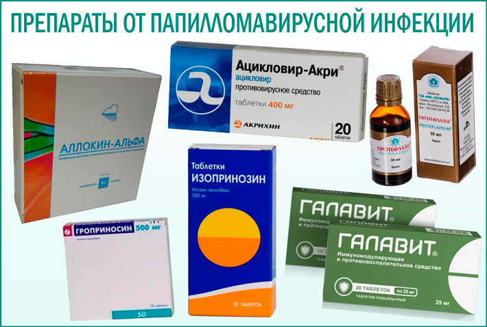 Как избавиться от папилломо-вирусной инфекции самостоятельно