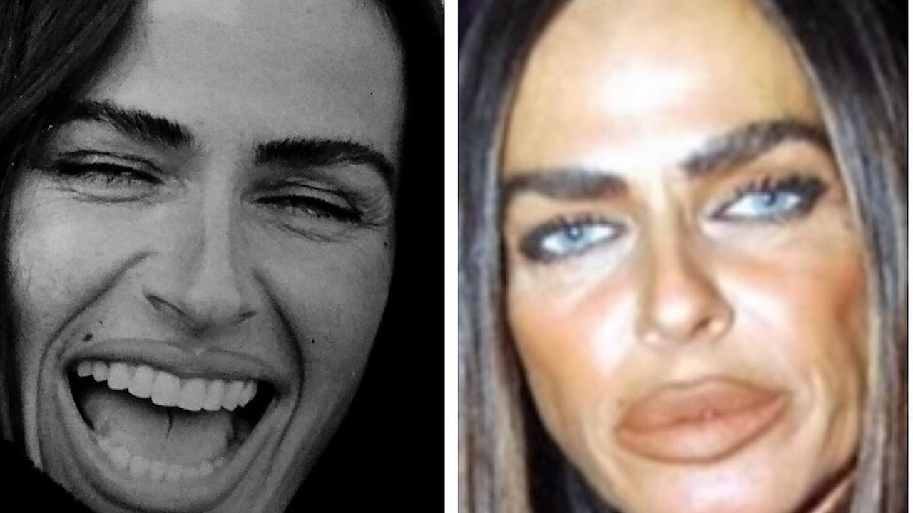 Самые неудачные хирургические вмешательства во внешность - t10p