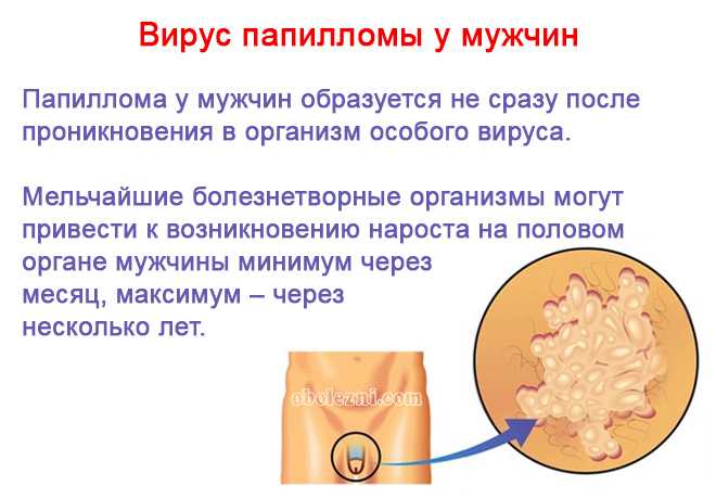 Как бороться с папилломами: как вылечить папилломы на шее