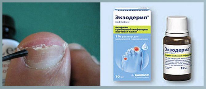 Экзодерил от грибка ногтей и кожи: аналоги, инструкция по применению