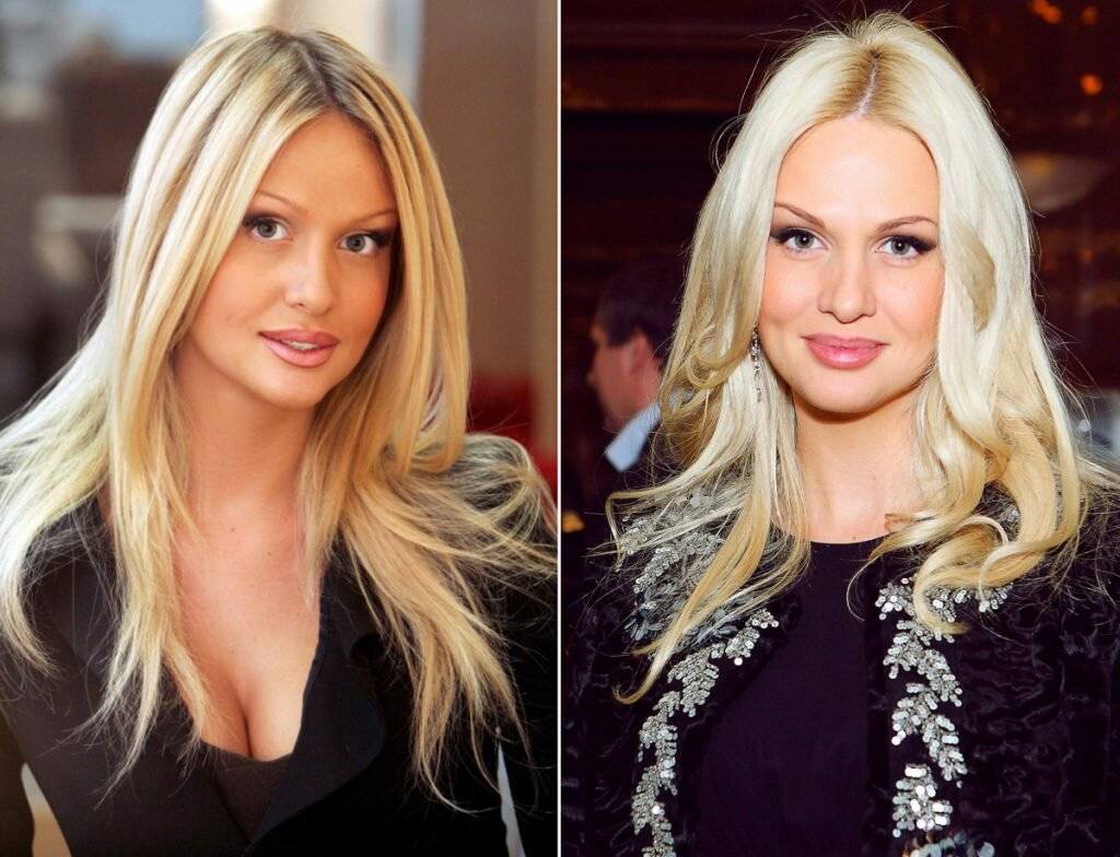 Виктория лопырева до и после пластических операций, фото и видео