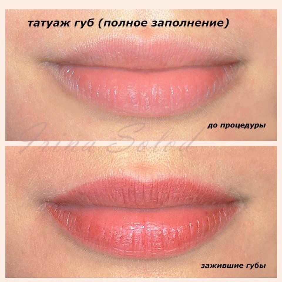 Татуаж губ: фото до и после процедуры, заживление по дням, уход