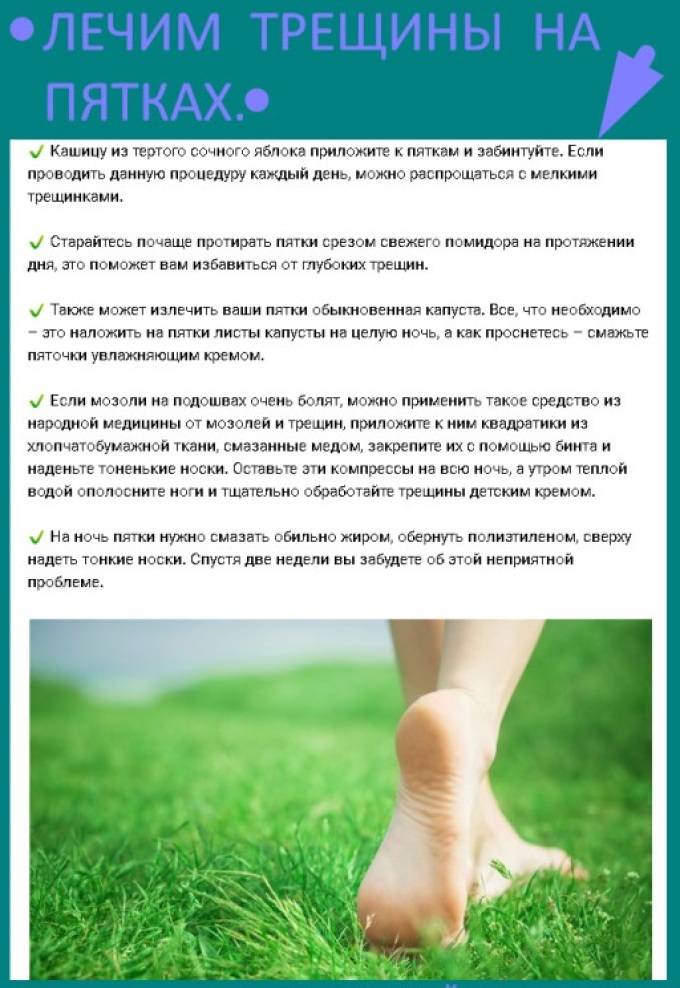 Как сделать пятки гладкими: 10+ способов избавления от трещин и огрубевшей кожи