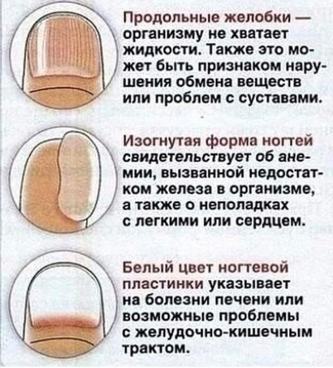 Полоски на ногтях - белые, черные, красные: причины появления, лечение, фото