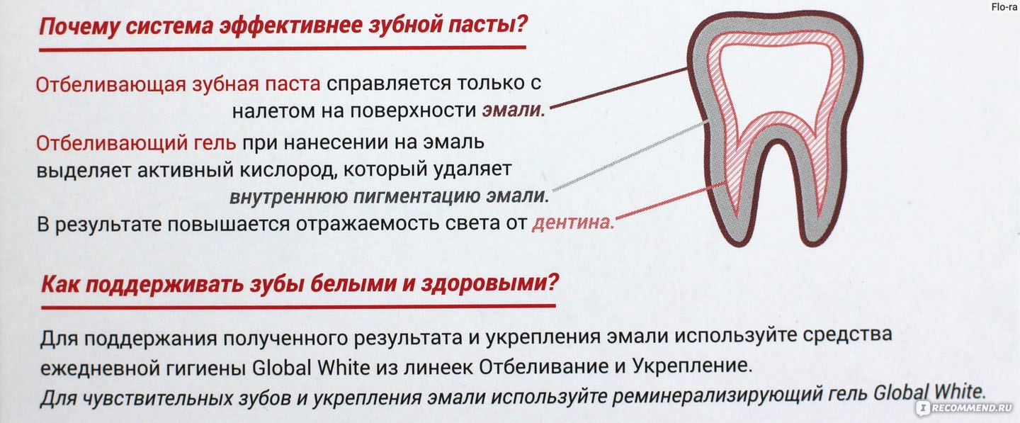 White отбеливание зубов, преимущества и недостатки процедуры