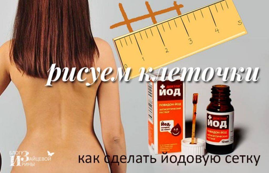 Можно ли увеличить грудь с помощью йода: преимущества и недостатки этого метода