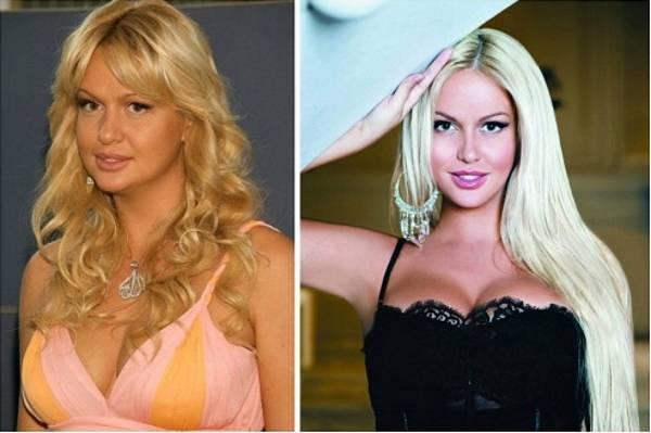 Виктория лопырева до и после пластических операций, фото и видео » womanmirror виктория лопырева до и после пластических операций, фото и видео