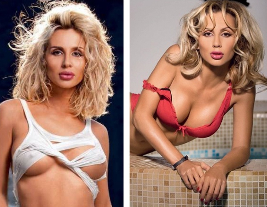 Что у лободы с губами. светлана лобода: фото до и после пластических операций. какие пластические операции делала светлана лобода