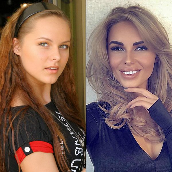 Певица ханна до и после операции. ханна и сенсационные пластические операции: новое лицо – путь к успеху