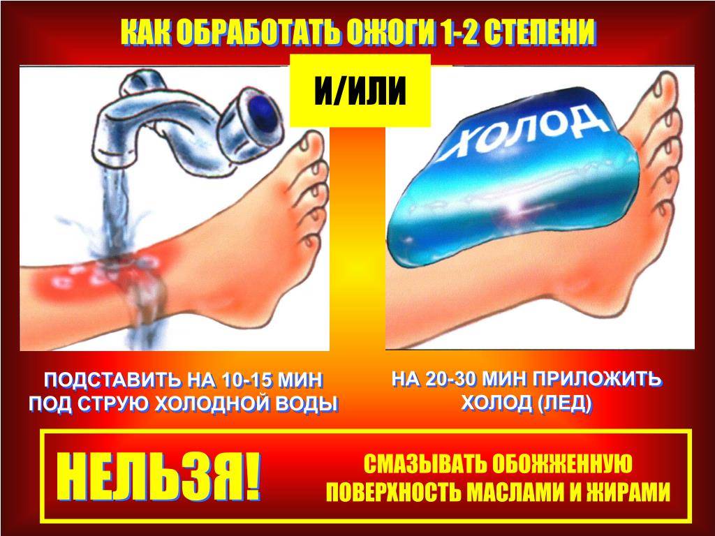 Почему на месте ожога