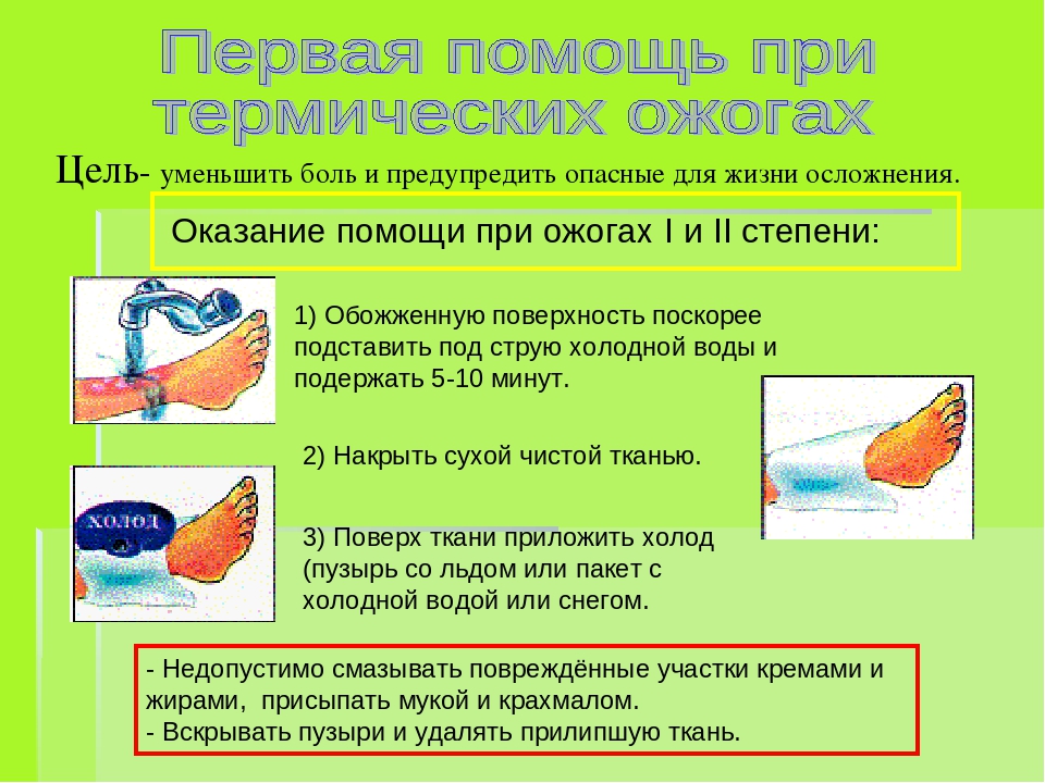 Первая помощь при термических и солнечных ожогах